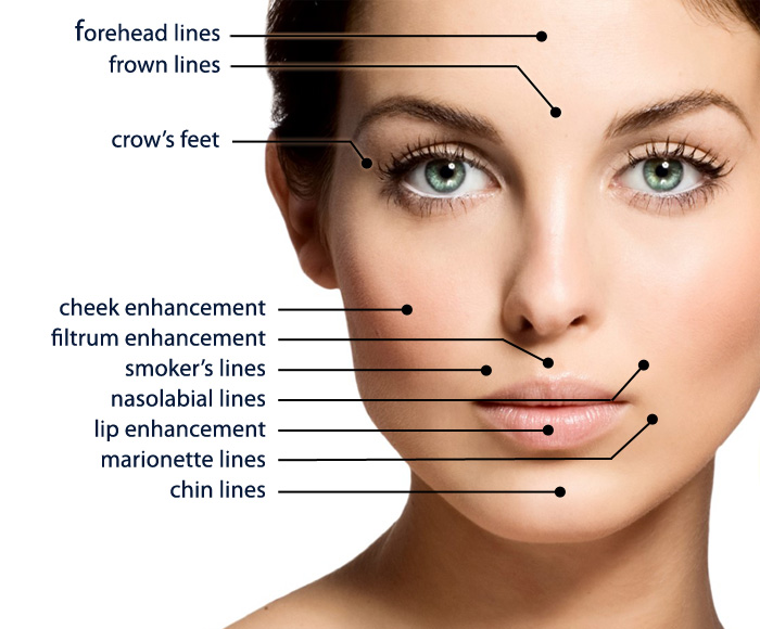 dermal fillers improve